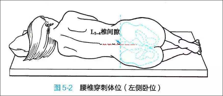 图源：《神经病学》第 8 版