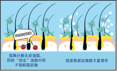 春雨医生